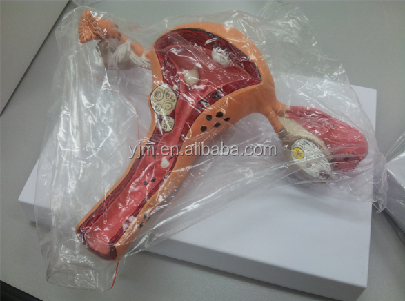 antomical腎臓モデル問屋・仕入れ・卸・卸売り