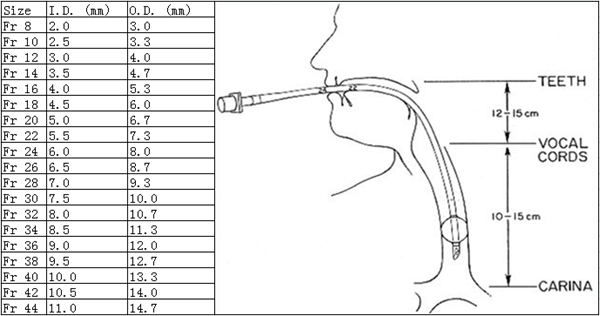 X線可視化精密フロー制御鼻腔/口腔シリコーン気管内チューブ仕入れ・メーカー・工場