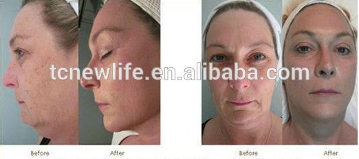 -nl-spa2012014年hydrafacialマシンce問屋・仕入れ・卸・卸売り