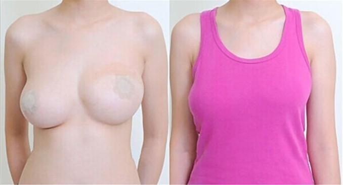 サテン花びらヌード乳房乳首カバーのステッカーラウンドパッチのスパンコールブラジャー仕入れ・メーカー・工場