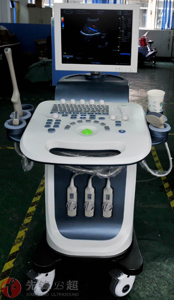 ポータブルドップラーマシンxf7700ultrsoundusbインタフェースを備えた、 妊娠のためのラップトップのためのプローブ仕入れ・メーカー・工場