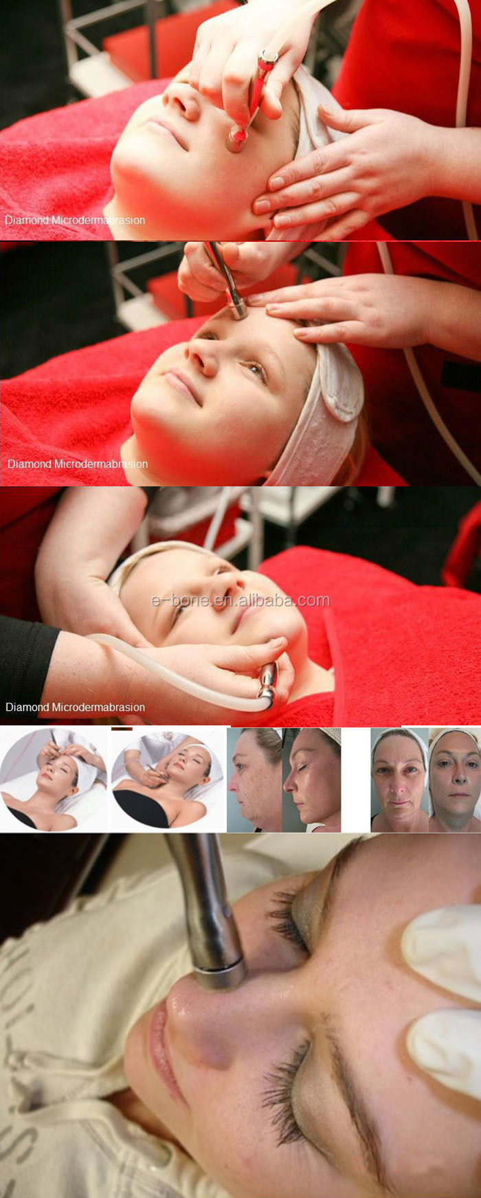101で皮膚が剥離クリスタルダイヤモンドの皮膚剥離のmicrodermabrasionのマシン問屋・仕入れ・卸・卸売り