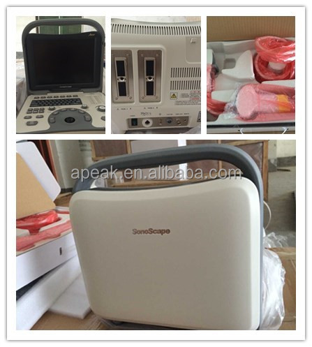 Sonoscapea6黒と白のポータブル超音波機器fda、 腹部にce認定品、、 msk、/obgyn、 血管仕入れ・メーカー・工場
