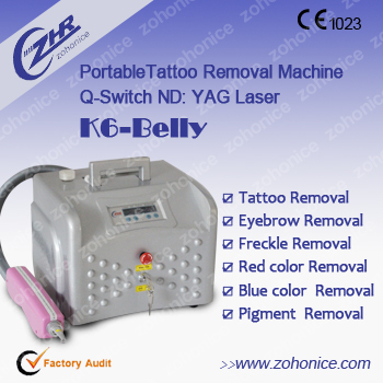 Yag Laser Tattoo Removal Machine Low Price - Buy Laser Tattoo Removal ...