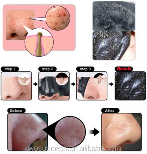 deep cleansing purifying peel off the black head, acne treatment, black mud face mask facial mask .jpg