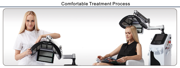 プロのヘア損失処理装置ですはげの男性と女性 問屋・仕入れ・卸・卸売り