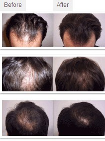treatment results