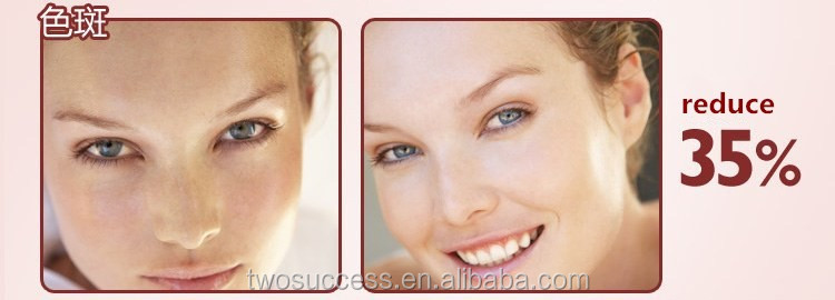 eye wrinkle remover machine (2).jpg