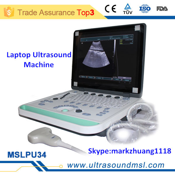 高品質な3dmslpu34zラップトップの超音波装置のための妊娠検査仕入れ・メーカー・工場