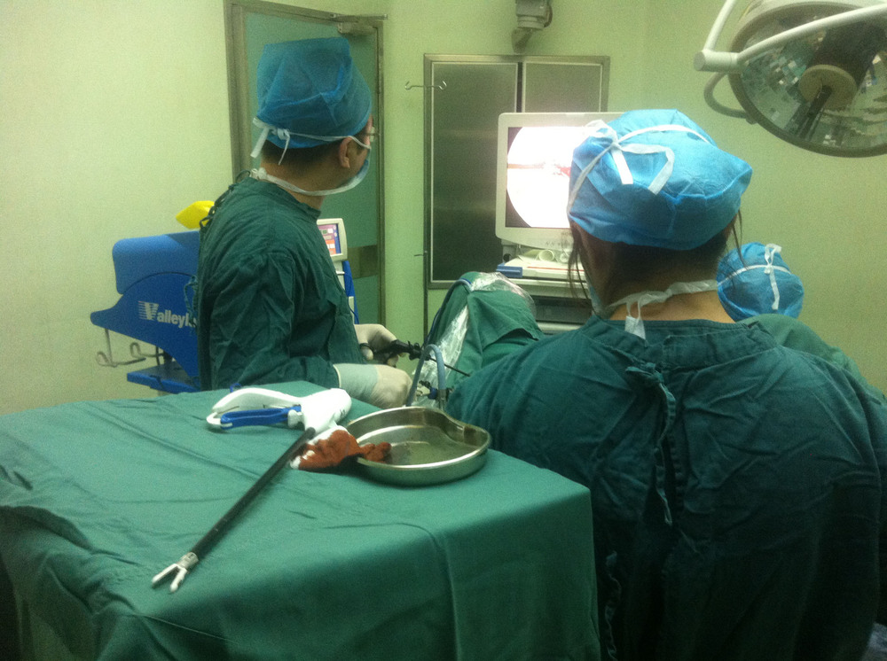 婦人科腹腔鏡器具製造価格仕入れ・メーカー・工場