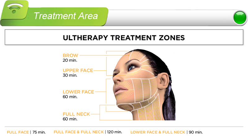 新しいマシン2015ultherapyhifuマシンのパートナーを探してヨーロッパピン付- ポイント加熱、 33治療の深さのためのヒント問屋・仕入れ・卸・卸売り