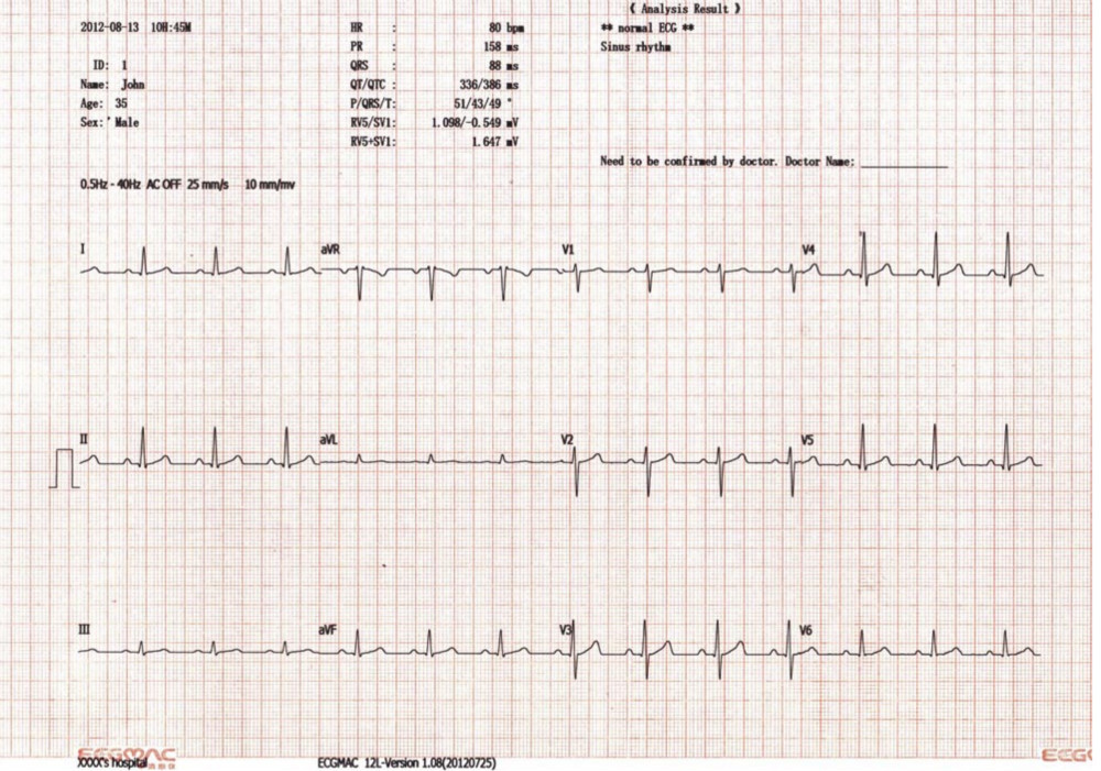 デジタルem-120312- チャネルecg/ekg、 12インチカラーlcdとサポートpcl言語外部プリンタecgマシン仕入れ・メーカー・工場