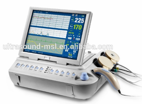 Fetal Monitor Mars B_.jpg