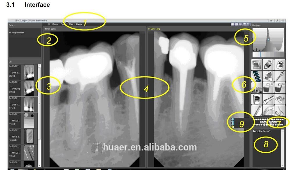 デジタル歯科用x線センサー/高品質のワイヤレスusbデジタル歯科デジタルx線センサー仕入れ・メーカー・工場