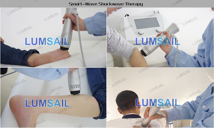 smartwave衝撃波治療システム仕入れ・メーカー・工場