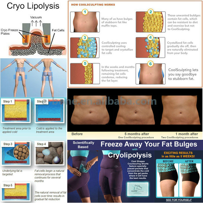 多機能体重損失売れ筋cryolipolysisマシン問屋・仕入れ・卸・卸売り
