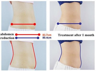 Burning fat instead of carbohydrates photo 5